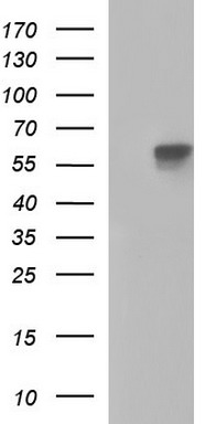 PHF7 antibody