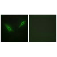 PHKA1 Antibody