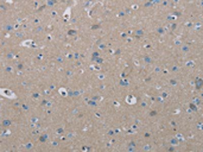 PHKA2 Antibody
