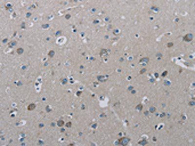 PHKA2 Antibody