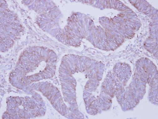 PHKA2 antibody [C3], C-term