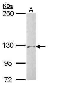 PHKA2 Rabbit Polyclonal Antibody