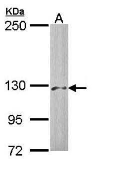 PHKA2 antibody