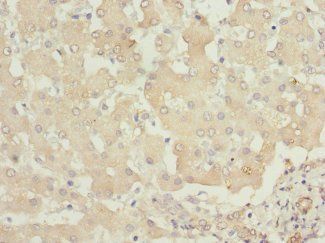 PHKB Antibody