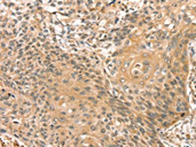PHKB Antibody