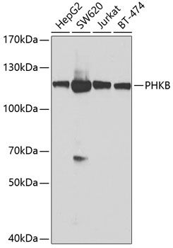 PHKB antibody