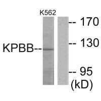 PHKB Antibody