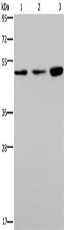 PHKG1 Antibody