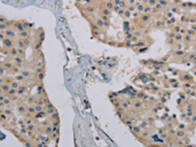 PHKG1 antibody