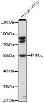 PHKG1 antibody