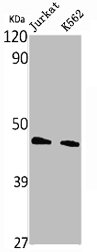 PHKG1 antibody