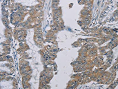 PHKG2 Antibody