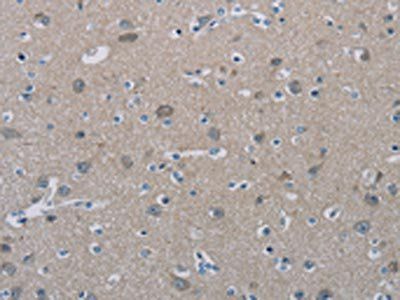 PHKG2 Antibody