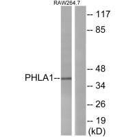 PHLDA1 antibody