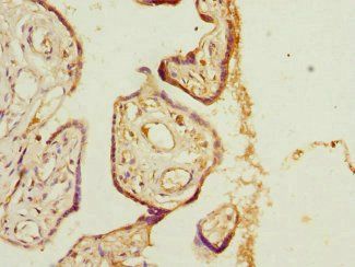 PHLDA2 Antibody