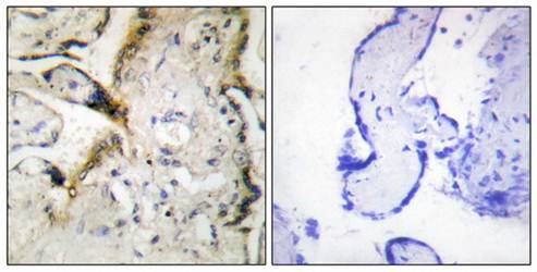 PHLDA3 antibody