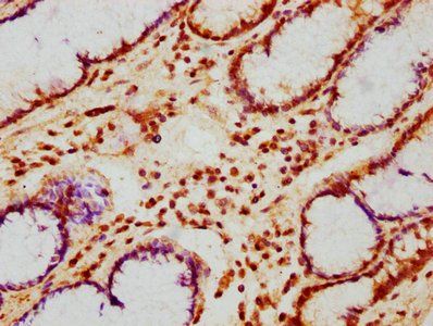 PHLDB1 Antibody