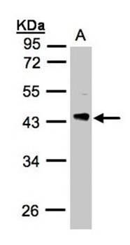 PHLP antibody