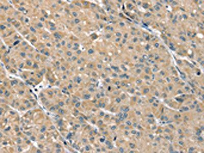 PHLPP1 Antibody