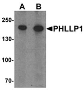 PHLPP1 Antibody