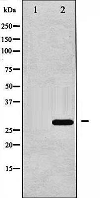 14-3-3 zeta (Phospho-Ser58) antibody
