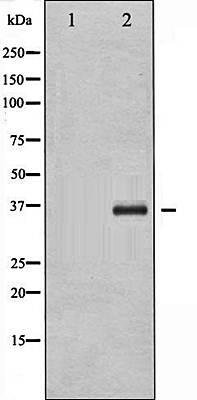 C/EBP-beta (Phospho-Thr235/188) antibody