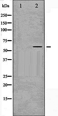 COT (Phospho-Thr290) antibody
