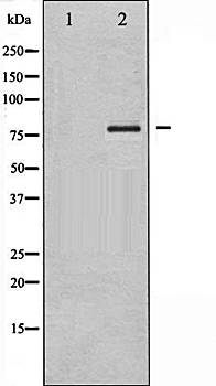 FOXO1/3/4-pan (Phospho-Thr24/32) antibody