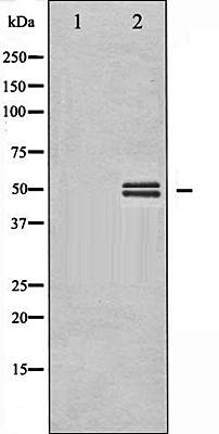GSK3 alpha/ beta (Phospho-Tyr279/216) antibody