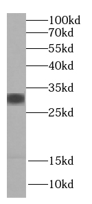 phospho-Marcks antibody