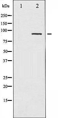 PKC alpha (Phospho-Thr638) antibody