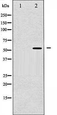 PPAR-gamma (Phospho-Ser112) antibody