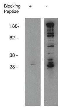 phospho-Sphingosine Kinase 1 antibody