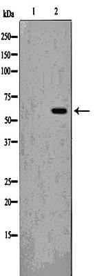 Src(Phospho-Tyr529) antibody