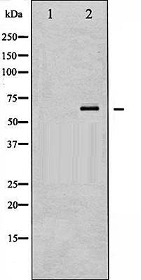 SYK (Phospho-Tyr323) antibody