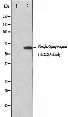 Synaptotagmin(Phospho-Thr202) antibody
