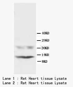 Phospholamban/PLN Antibody