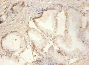 PLA2G2A Antibody