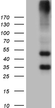 Phospholipase A2 IIA (PLA2G2A) antibody