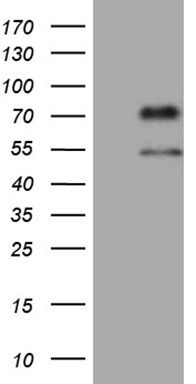 Phospholipase A2 IIA (PLA2G2A) antibody