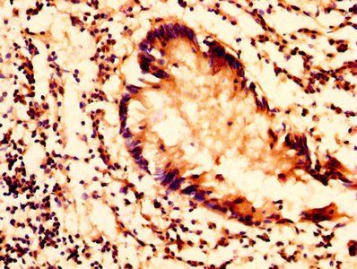 Phospholipid transfer antibody