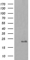 Phosphoribosyl pyrophosphate amidotransferase (PPAT) antibody