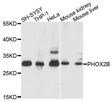 PHOX2B antibody