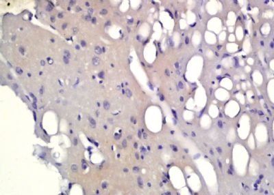 PHOX2B Rabbit Polyclonal Antibody