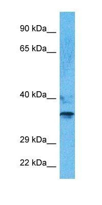 PHX2B antibody