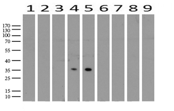 PHYHD1 Antibody