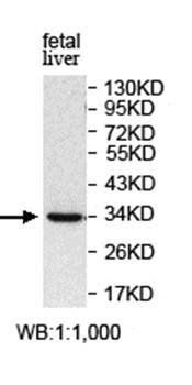 PHYHD1 Rabbit Polyclonal Antibody