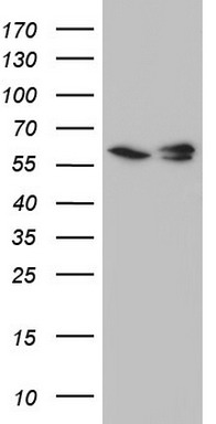 PI 3 Kinase catalytic subunit alpha (PIK3CA) antibody