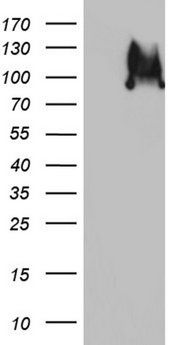 PI 3 Kinase Class 2A (PIK3C2A) antibody