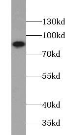 PI3K p85 (alpha) antibody